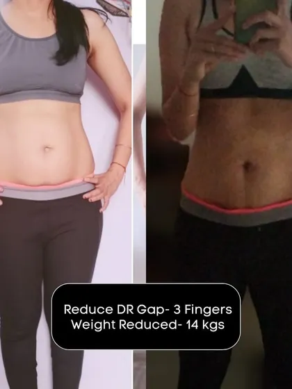 A powerful transformation showing a 14 kg weight loss and a 3-finger reduction in diastasis recti. This is the result of dedication and a plan that works.
