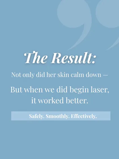 The result of our patient approach? Her skin calmed down, and when we did begin the laser treatment, it worked better: safely, smoothly, and effectively.