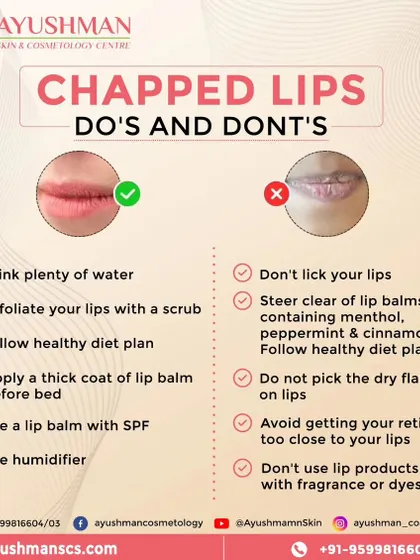 This helpful infographic provides essential do's and don'ts for managing chapped lips. Simple habits like staying hydrated and using SPF lip balm can make a huge difference for a healthier pout.