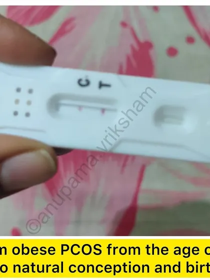 This student had obese PCOS from the age of 13 and a stressful job. By focusing on diet and exercise to regulate her periods, she was able to conceive naturally.