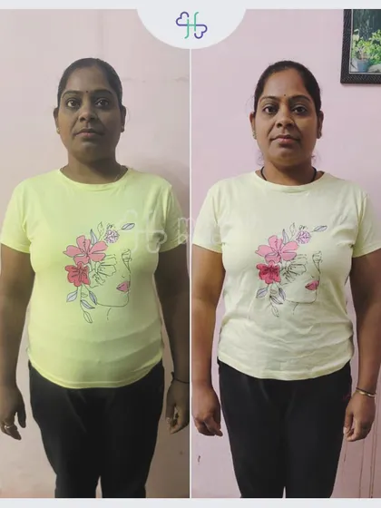 Rekha lost 9 kgs in 12 weeks after trying gym and yoga with no results. The right nutrition guidance made all the difference.