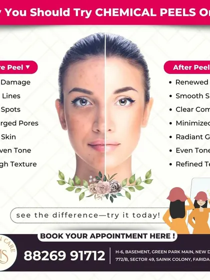 This before-and-after graphic clearly shows the transformative power of chemical peels. They are effective for a range of issues including sun damage, fine lines, enlarged pores, and uneven skin tone, resulting in renewed, smoother skin.