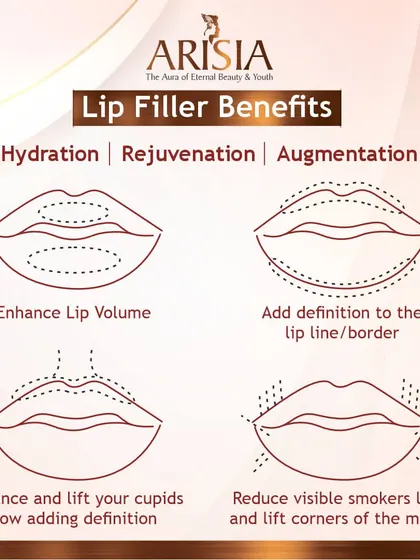 Lip fillers do more than just enhance volume. They provide hydration, add definition to the lip border, enhance the cupid's bow, and can even reduce visible smoker's lines for overall lip rejuvenation.