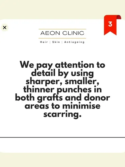 Why choose us? We pay close attention to detail, using sharper, smaller, and thinner punches for both grafts and donor areas to minimize scarring.