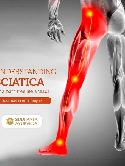 This visual illustrates the path of the sciatic nerve, helping you understand how pain can radiate down the leg. My blog provides further details on how Ayurveda can offer relief without invasive procedures.