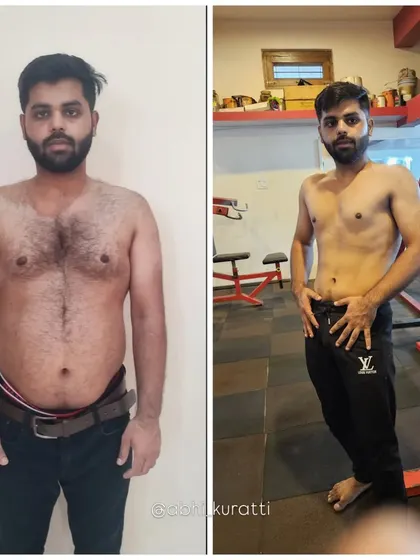 A side-by-side comparison of Anurag's 5-month journey. He dropped 10 kgs and proved that even with medical conditions, progress is possible with the right guidance.