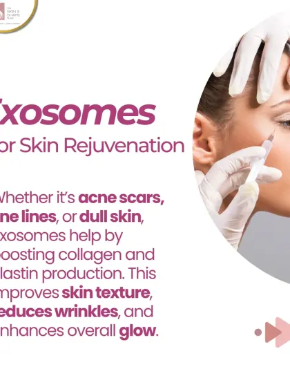 For skin rejuvenation, Exosomes work by boosting collagen and elastin production. This helps improve skin texture, reduce wrinkles, and enhance your overall glow, making it a great treatment for acne scars and fine lines.