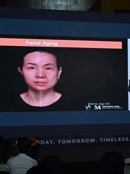 A slide from the international program demonstrating the effects of facial aging. Visuals like these are powerful tools for understanding the anatomical changes we aim to address with our treatments.