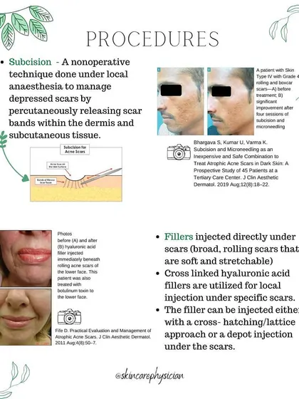 Subcision and dermal fillers are excellent options for treating depressed scars like rolling scars. Subcision releases the bands pulling the scar down, while fillers help to lift the area and restore lost volume for a smoother appearance.
