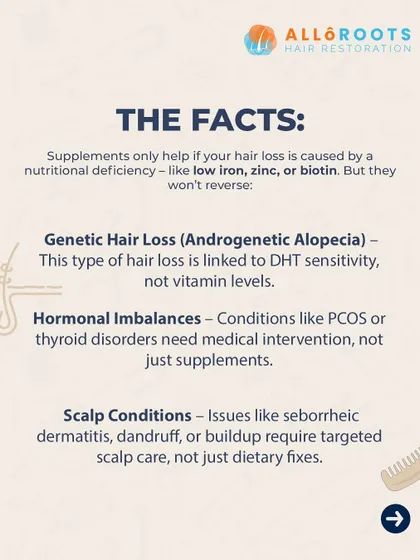 Here are the facts. Supplements are only effective if a nutritional deficiency like low iron or zinc is the confirmed cause of your hair loss. They do not work for genetic hair loss, hormonal imbalances like PCOS, or scalp conditions, which all require targeted medical intervention.