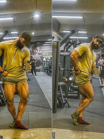 Maintaining leg development with multiple knee and back injuries is a constant challenge. These poses show the leg musculature I've managed to build and maintain through intelligent training, proving that pain doesn't have to be a permanent stop sign.