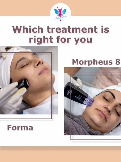 Forma or Morpheus8? This graphic helps explain the difference. Forma is fantastic for a gentle lift and pre-event glow, while Morpheus8 goes deeper to treat wrinkles, acne scars, and other texture issues.