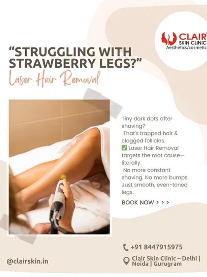 If you're struggling with "strawberry legs" or tiny dark dots after shaving, you are not alone. Our laser hair removal targets the root cause by treating trapped hair and clogged follicles for smooth, even-toned legs.