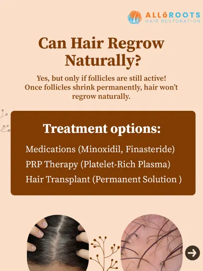 Natural hair regrowth is possible, but only if the hair follicles are still active. This graphic outlines the primary treatment options I use, including medications like Minoxidil and Finasteride to revive follicles, and regenerative PRP therapy to stimulate growth.