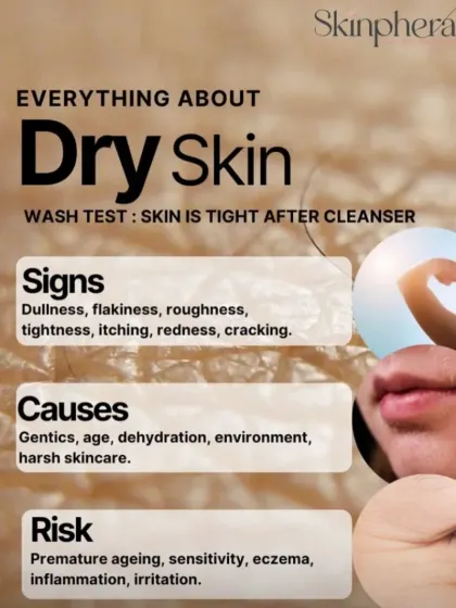A guide to understanding dry skin. I explain the signs, such as flakiness and tightness, the causes, and the risks of premature ageing if left untreated.