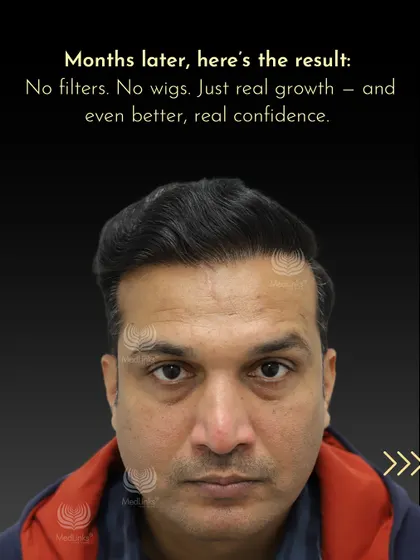 Months later, the result is real growth and, more importantly, real confidence. No filters, no wigs, just results.
