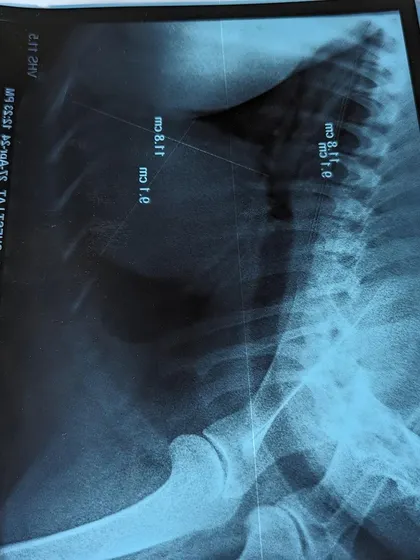 A side view of Buddy's chest X-ray. These tests are expensive but non-negotiable for providing proper care.