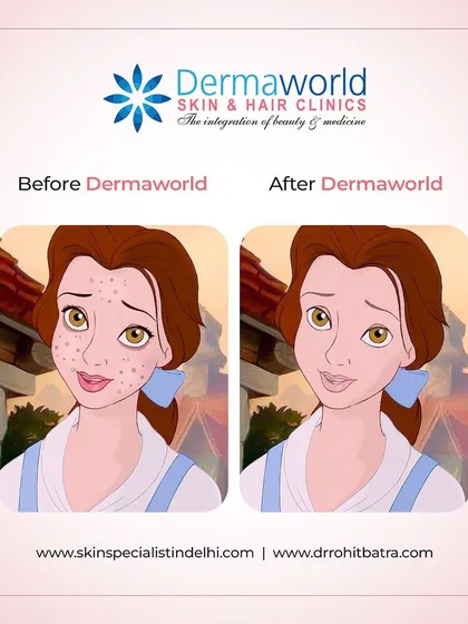 Everyone deserves to feel like the best version of themselves. If skin problems are holding you back, we can provide the expert solutions you need to achieve a clear and confident "after" photo.
