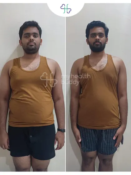 This was Gowtham after the first 12 weeks, having already lost 12 kgs. This initial progress built the momentum for his total 20kg transformation.
