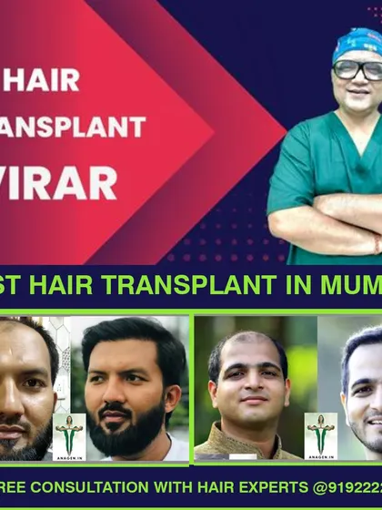 Residents of Virar can access our high density Biotech Instant FUE procedures. This graphic showcases the excellent hairline design and scar free results we provide to our Mumbai based clients.