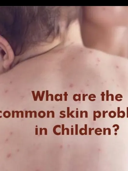 "What are the common skin problems in children?" is a question I hear often. I am here to provide answers and relief for conditions like viral rashes, infections, and allergies, ensuring your child gets the expert care they need.