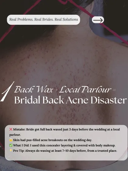 Bridal Emergency 1: Back acne from a bad wax. Pro tip: Always get waxing done at least 7-10 days before your wedding from a trusted salon to avoid last-minute breakouts.