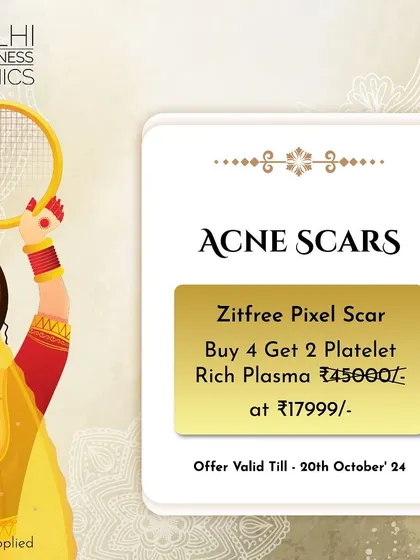 Our Karwa Chauth special offer for acne scars, combining Zitfree Pixel Scar treatment with complimentary Platelet Rich Plasma sessions.