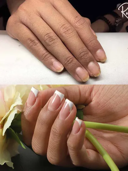 A before-and-after of a classic French manicure. A clean, timeless look that enhances the natural beauty of the hands.