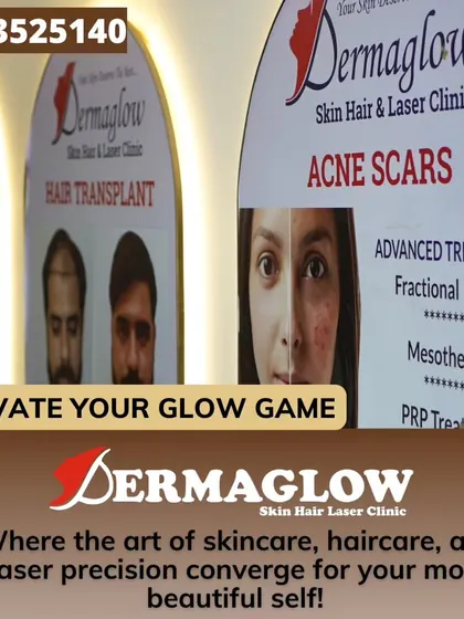 This view of our clinic's service boards highlights our focus on advanced treatments for concerns like acne scars and hair loss. We offer procedures such as Fractional Lasers, Mesotherapy, and PRP Treatment to provide effective, targeted solutions for our clients.