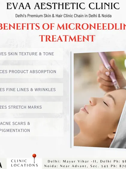 Discover the benefits of Microneedling, including improved skin texture, enhanced product absorption, reduced fine lines, and faded acne scars and hyperpigmentation.
