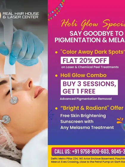 Say goodbye to pigmentation and melasma this Holi with my glow special. Get a flat 20% off on laser and chemical peels, a buy 3 get 1 free combo on pigmentation removal, and a free sunscreen with any melasma treatment.