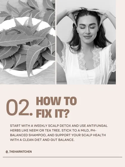 If your scalp is always itchy, here's how to fix it. Start with a weekly scalp detox using antifungal herbs like neem, stick to a mild shampoo, and support your health with a clean diet.