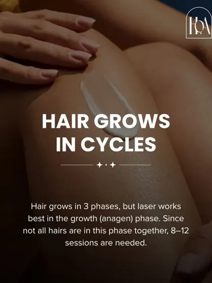 Understanding the science helps set expectations. Hair grows in three phases, and laser is most effective during the active growth (anagen) phase. This is why multiple sessions are necessary to catch every hair in the right cycle.