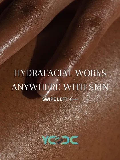 HydraFacial works anywhere you have skin. I offer targeted body treatments to address various concerns and help you achieve your skin goals from head to toe.
