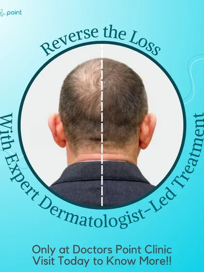 We can help you reverse hair loss with expert, dermatologist-led treatments. We offer personalized approaches to diagnose the cause of your hair loss and find the right solution for you.