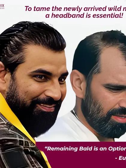 A look at the results of Indian cricketer Mohammad Shami, a name that inspires many of our guests to seek treatment.