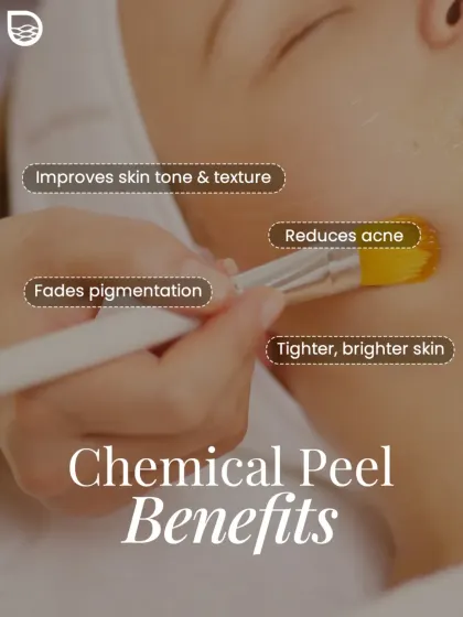 A chemical peel is a powerful tool for skin renewal, as shown in this treatment application. I use specific formulations to improve skin tone and texture, reduce active acne, fade post-inflammatory pigmentation, and reveal tighter, brighter skin.