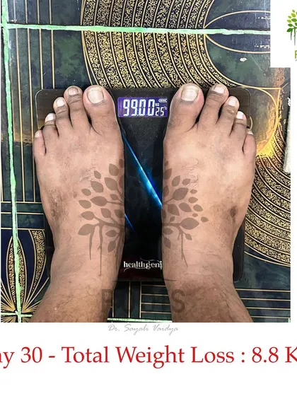 A 30-day transformation. This client achieved a healthy, sustainable weight loss of 8.8 kgs through a personalized Ayurvedic diet and lifestyle plan, without any crash dieting or extreme workouts.