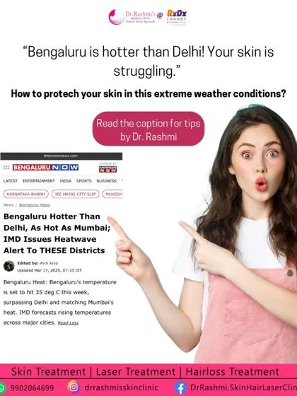 With Bengaluru's extreme heat, protecting your skin is more important than ever. This post shares my top tips, including hydrating inside and out, using SPF 50+ religiously, and switching to lightweight products to prevent clogged pores.