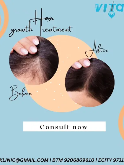 This before and after comparison highlights the effectiveness of our hair growth treatments in increasing hair density and reducing the visibility of the scalp. We diagnose the root cause of hair fall to provide a targeted and effective solution.