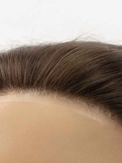 A macro shot of a seamless hairline. This is the level of detail we strive for, ensuring our hair systems are completely undetectable.