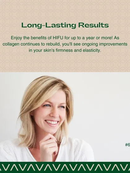 The results from HIFU are long-lasting, often for a year or more. As your skin continues to rebuild collagen, you will notice ongoing improvements in firmness and elasticity.