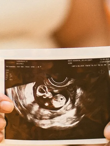 Holding the first glimpse of their baby. This macro shot of the ultrasound image is a powerful reminder of the miracle growing inside.