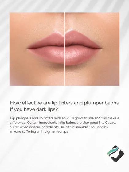 While lip plumpers and tinters with SPF can help, for more significant pigmentation, lip neutralization offers a more lasting solution to even out lip color.