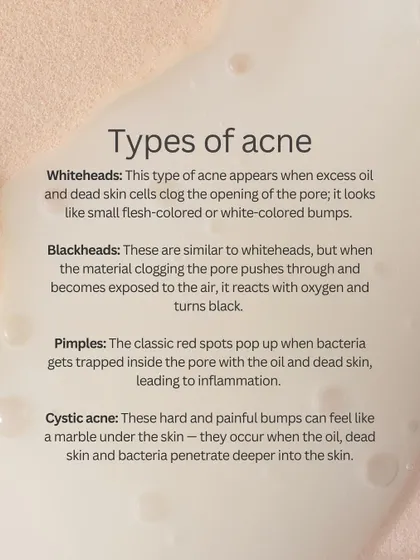 Do you have whiteheads, blackheads, or cystic acne? This guide explains the different types of acne, helping you understand what's happening with your skin.