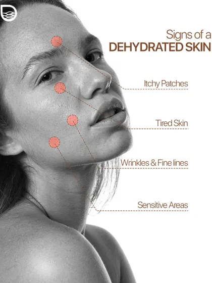 Dehydrated skin can feel tired, itchy, and show more prominent fine lines. It's a condition that can affect any skin type, including oily skin.
