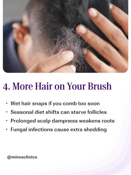 More Hair on Your Brush: Wet hair is fragile and prone to snapping. During monsoon, prolonged dampness weakens the roots, leading to increased shedding. It's important to be gentle and avoid combing hair when it's soaking wet.