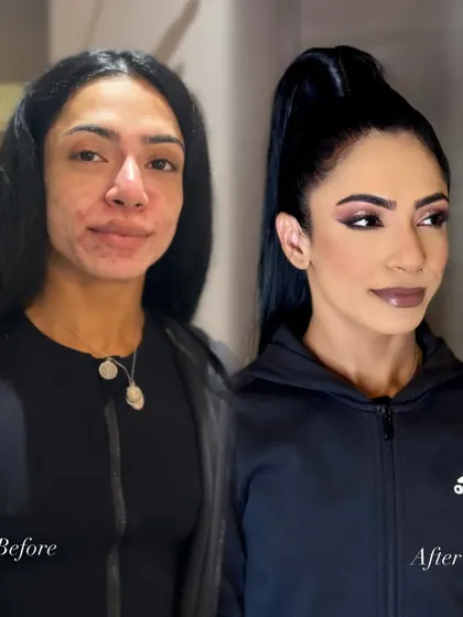 A dramatic transformation for a modern, high-ponytail look. Even with skin concerns like acne, the right technique creates a smooth, camera-ready finish.