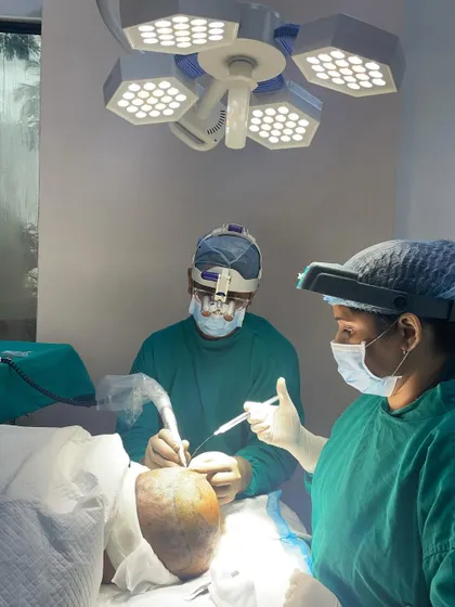 Keeping hair grafts hydrated is critical for their survival once they are outside the body. Here you can see a member of my team continuously hydrating the grafts during the procedure to ensure a survival rate of over 95 percent.