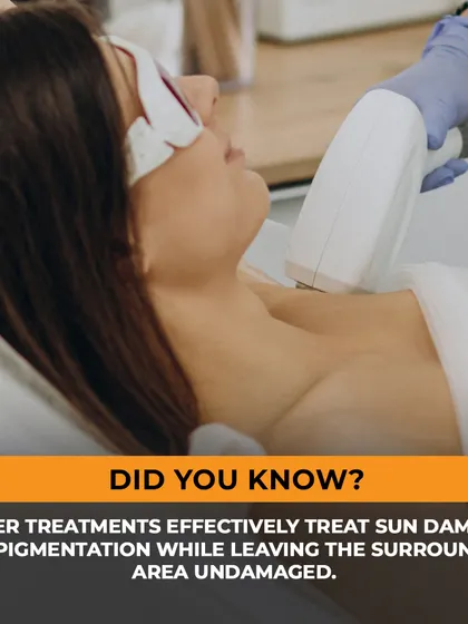 Did you know? Laser treatments are highly effective for sun damage and pigmentation because they can precisely target affected cells while leaving surrounding tissue unharmed.